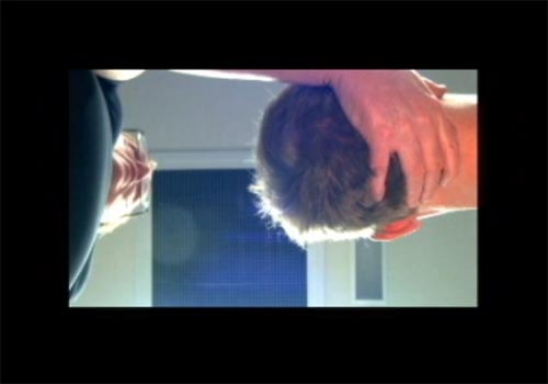 2. Tucker Posterior OA Anterior Atlas