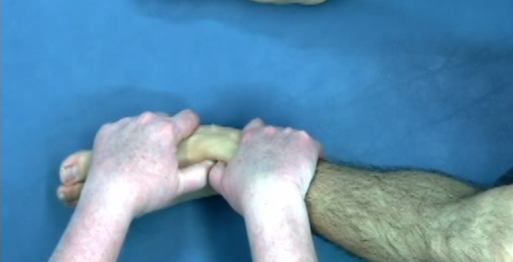 100. Crow Ankle Sprain