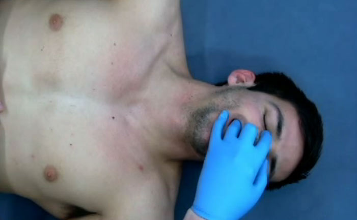 127. Lacrimal Duct Technique