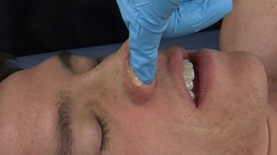 128. Intranasal Technique 1