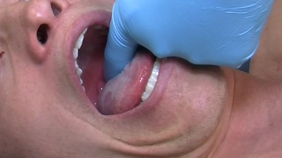 129. Muncie Technique