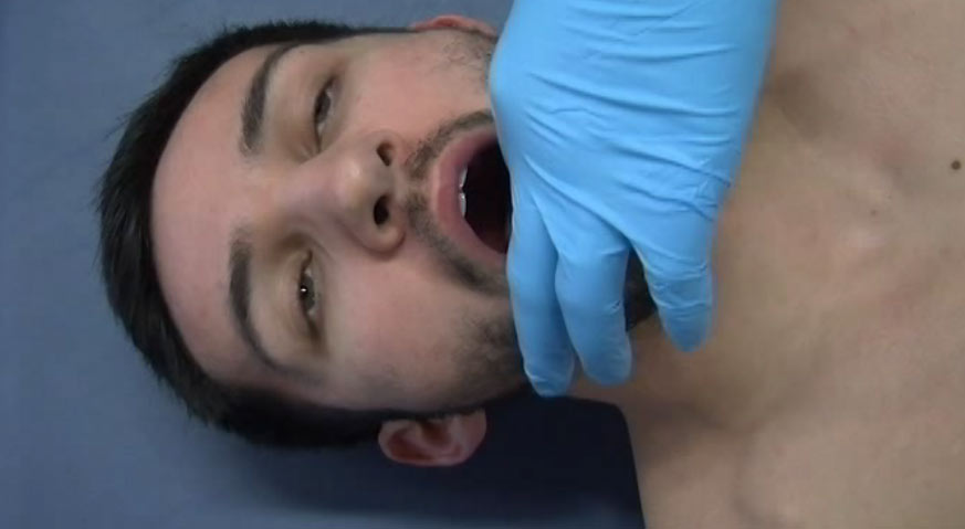 130. Root of Tongue Miller Technique-2005