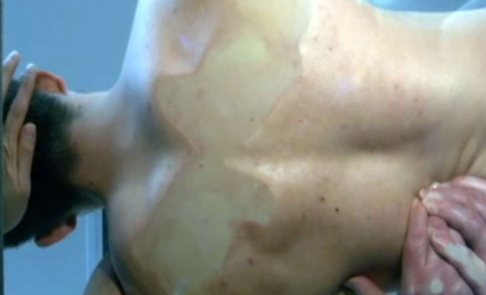 145. Sutherlands Approach to the Stomach