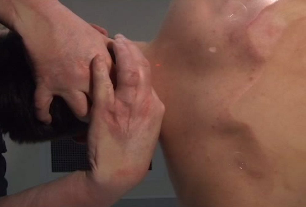 21. Technique of OA and Upper Cervical Technique (CROW)