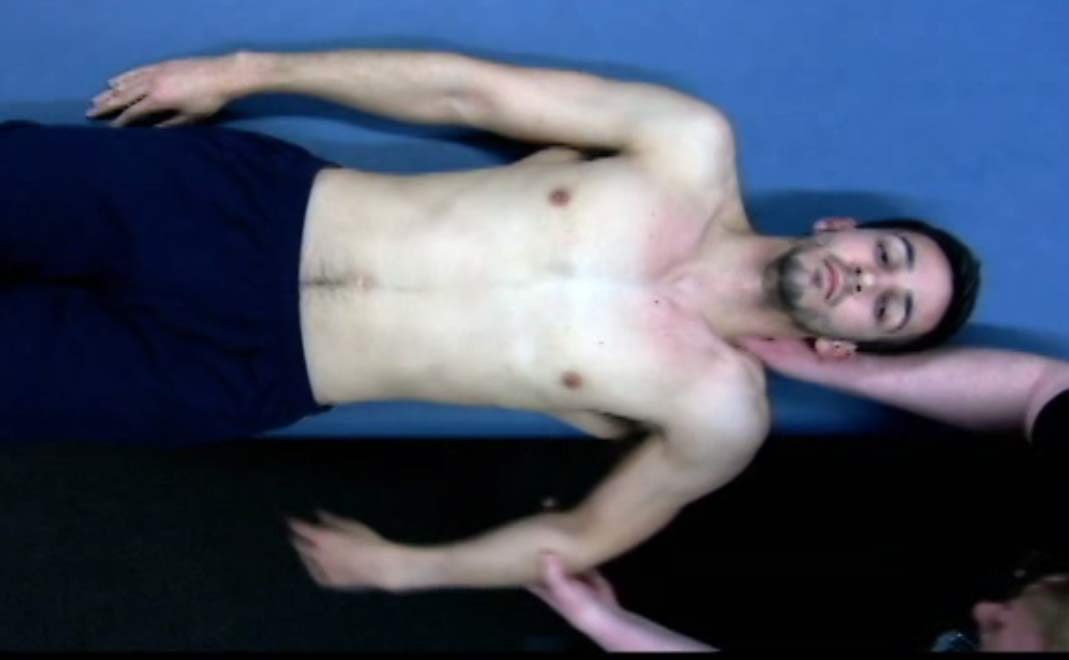 37. William Wests First Rib Supine Technique