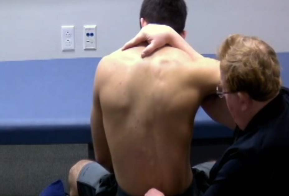 64. Ernest Tucker Lumbar Spine-3